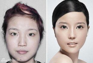 脸部整形图片,探索现代整形美容的奇迹之旅